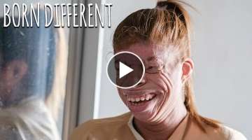 Only 20 People In History Were Born Like Me | BORN DIFFERENT